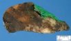 pulmonary osteosarcoma metastasis