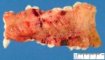 Intestinal mucosal hemorrhages and ulceration in shock