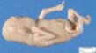 Cyclopia