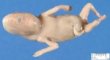 Cyclopia