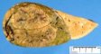 Formalin-fixed hepatoblastoma
