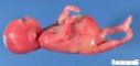 prune belly sequence