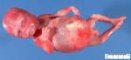 prune belly sequence