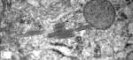 Birbeck granules