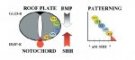 SHH/BMPs gradients in neural tube closure