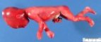 Abdominal wall defects