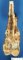 Femoral osteosarcoma (Case 12617)