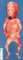 Fetus 18 weeks