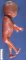 Fetal stiffness in fetal akinesia syndrome (Pena-Shokeir phenotype)