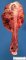 Femoral osteosarcoma