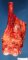 Femoral osteosarcoma (Case 12617)