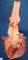 Dissection of proximal thoracic aorta in Marfan disease