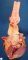 Dissection of proximal thoracic aorta in Marfan disease