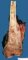 Femoral osteosarcoma