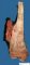 Femoral osteosarcoma