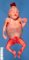 Posterior encephalocele and abdominal distension in Meckel syndrome