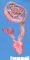 hydronephrosis with rectovesical fistula