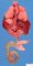 Horseshoe kidney associated with anorectal agenesis and rectovesical (...)