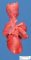 Preductal aortic coarctation in a malformative syndrome (fetus 26 (...)