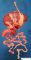 Duodenal dilatation by duodenal atresia in multiple intestinal atresia (...)