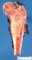 Femoral Ewing sarcoma