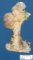 osteochondroma_06_