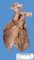 Preductal aortic coarctation in a malformative syndrome (fetus 26 (...)