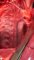 Pulmonary artery hypoplasia with right aorta