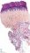 Retiform hemangioendothelioma