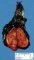 Thyroid follicular adenoma