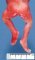 Asymmetric limb shortening in X-linked chondrodysplasia punctata type 2 (...)