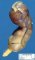 Meckel diverticula