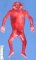 Anencephaly (fetus, 19 weeks)