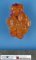 Paratesticular Leydig cell tumor