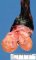 Testicular embryonal carcinoma