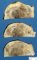 Femoral osteosarcoma (Case 12617)