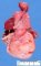 Megacystis sequence from urethral atresia in Vater association