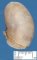 Vulvar mucous cyst