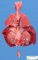 Bilateral renal agenesis
