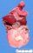 Megacystis sequence from urethral atresia in Vater association