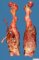 Femoral osteosarcoma