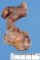Meckel diverticula