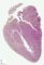 Fetal heart 18 weeks