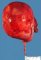 Cystic Wilms tumor