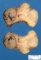 Hashimoto thyroiditis with nodular hyperplasia