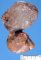 pleuropulmonary blastoma