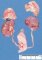 Fetal kidneys at 40 weeks