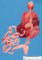 Anorectal atresia: imperforate anus and rectovesical fistula (22 (...)