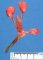 Rectourethral fistula