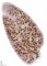 CD20 immunostaining of the spleen: lymphoid follicles of the white pulp are (...)